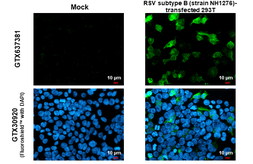 Anti-Respiratory Syncytial virus type B G protein antibody [HL1733] used in Immunocytochemistry/ Immunofluorescence (ICC/IF). GTX637381
